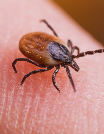 Tick crawling on human skin - Tick Pest Control